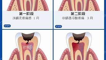 牙齿龋坏不治疗会怎样？牙科医生为你解答(牙齿龋坏不补有影响吗)